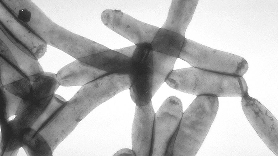 Legionellabacterie: Drie nieuwe besmettingen rond Maasmechelen